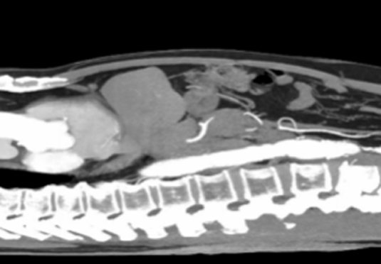除外惡液質晚期
